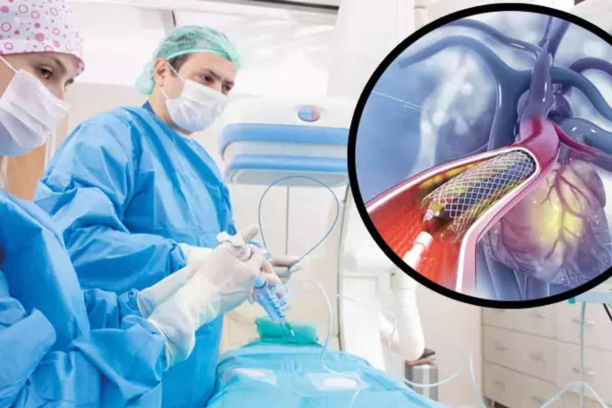 Uzmanlar, anjiyo salgınına karşı uyarıyor