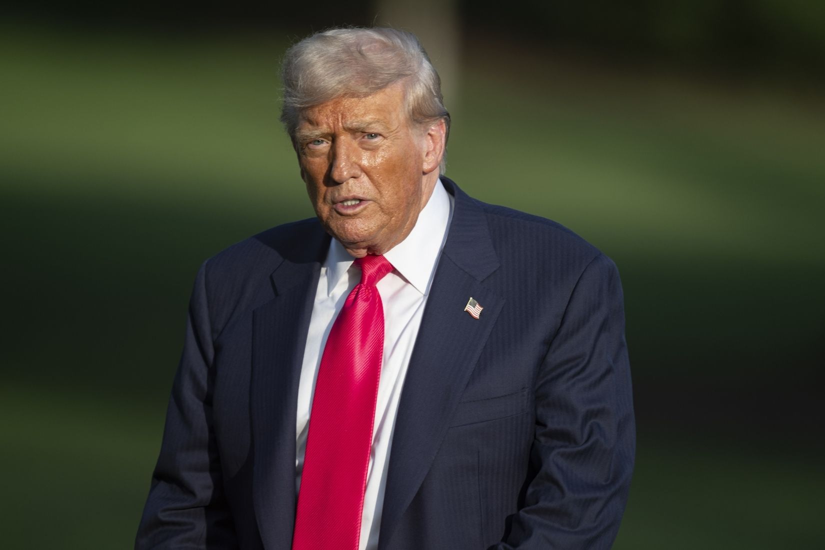 ABD Başkanı Donald Trump'ın ellerindeki morlukların ve ayaklarındaki şişliklerin sebebi açıklandı