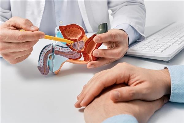 İyi huylu prostat büyümesine karşı anjiyo dönemi