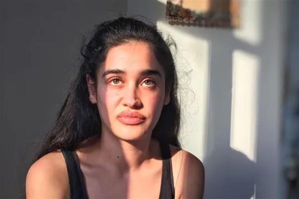 Amerika'da yaşayan oyuncu Meltem Miraloğlu saplantılı bir kişi tarafından darp edildi