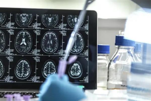 Alzheimer ilacı Donameab'a Avustralya onayı