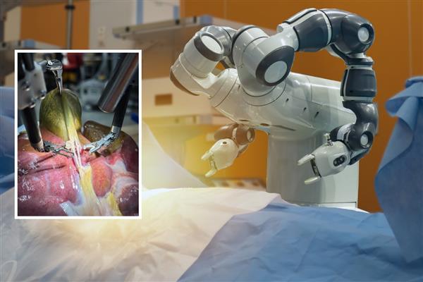 İlk kez bir robot, insan yardımı olmadan gerçekçi bir ameliyatı başarıyla tamamladı