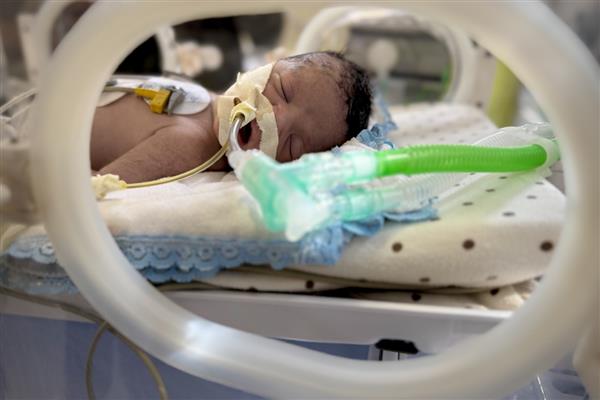 İsrail'in Gazze saldırısında hayatını kaybeden hamile kadının bebeği ağır yaralı olarak kurtarıldı