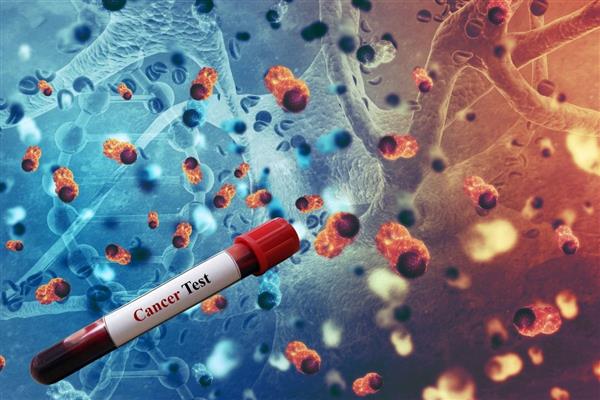 Yeni bir kan testi HPV ile ilişkili baş ve boyun kanserlerini 10 yıl erken teşhis edebiliyor