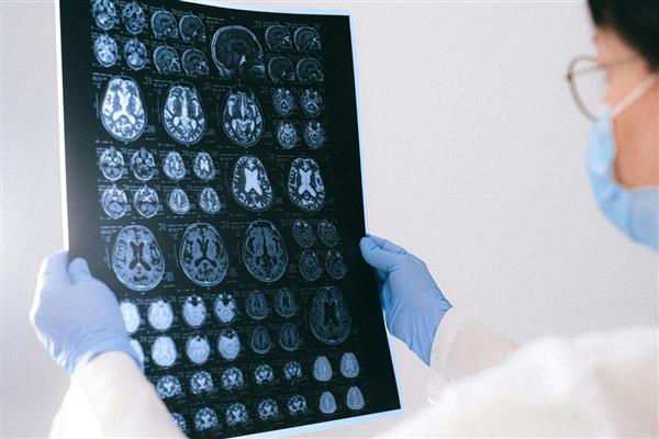 Bilim insanları Alzheimer'ı önceden tespit edebilmeyi sağlayan beynin 'gizli nabzı'nı buldu
