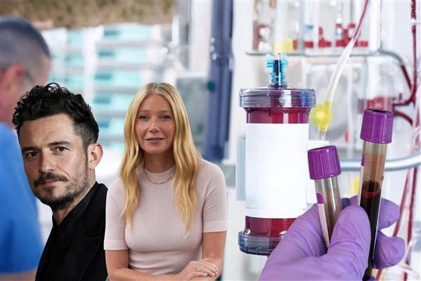 Hollywood yıldızları genç ve diri kalabilmek için kan filtreleme yaptılar, trend yarattılar