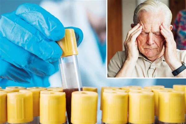 İngiltere'de parmak ucundan alınan kanla Alzheimer'ı erken teşhis edebilecek test geliştiriliyor