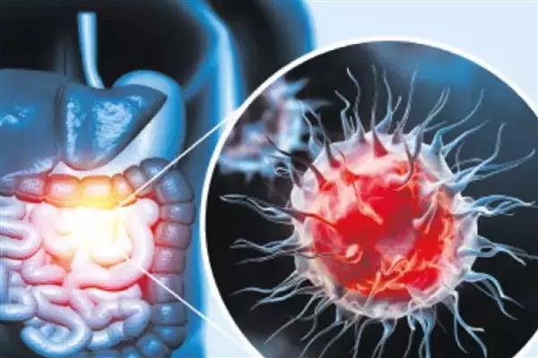 James Van Der Beek'in 48 yaşında ölümüyle gündeme gelen kolon kanseri 50 yaş altında hızla artıyor