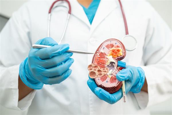 Sağlık Bakanlığı, Türkiye'de her 6-7 erişkinden birinde çeşitli evrelerde kronik böbrek rahatsızlığı görüldüğünü açıkladı