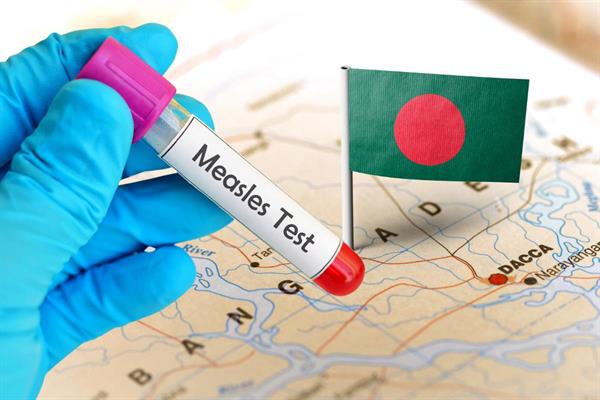 Bangladeş'te kızamık alarmı, 15 Mart'tan bu yana çocuk ölümleri hızla artıyor
